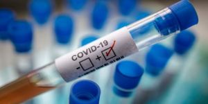 الولايات المتحدة تسجل 45,342 إصابة مؤكدة و 1,030 حالة وفاة بفيروس كورونا